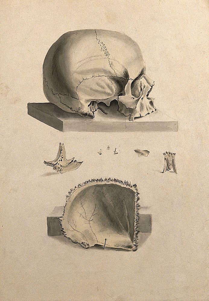 Human skull: six figures showing sections and an entire skull. Ink and watercolour, 1830/1835, after W. Cheselden, ca. 1733.