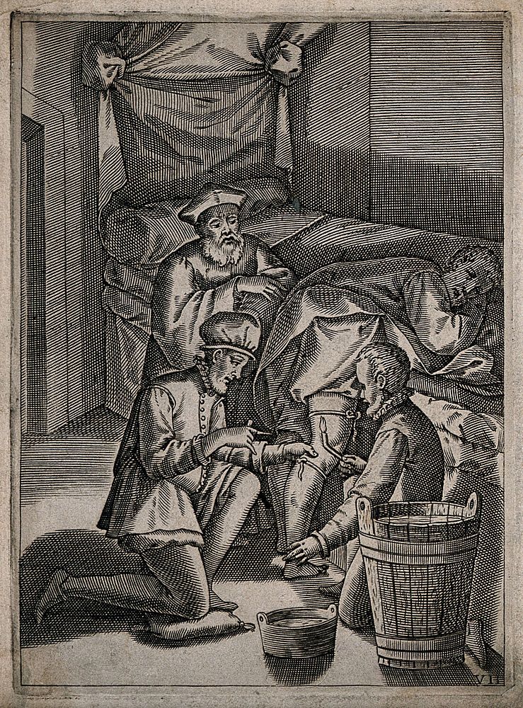 A surgeon about to bleed a male patient's leg, he is observed by an older physician and aided by an assistant. Engraving…