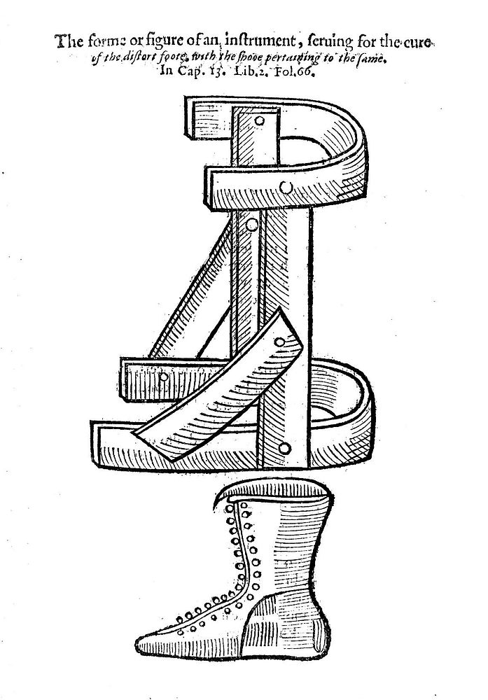 A most excellent and compendious method of curing woundes in the head, and in other partes of the body, with other precepts…