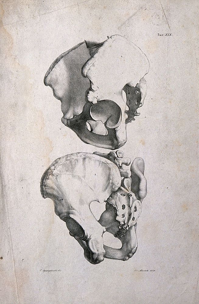 Pelvis: two figures. Lithograph by Martelli after C. Squanquerillo, 1838.