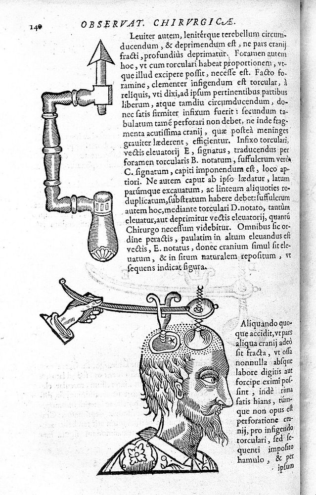 Guilhelmi Fabricii Hildani ... Observationum et curationum chirurgicarum centuriae, nunc primum in unum opus congestae, ac…