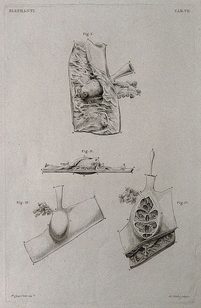 Dissection of the internal organs of an elephant: four figures. Etching by R. Vinkeles 1787/1800 , after P. Camper, 1774.