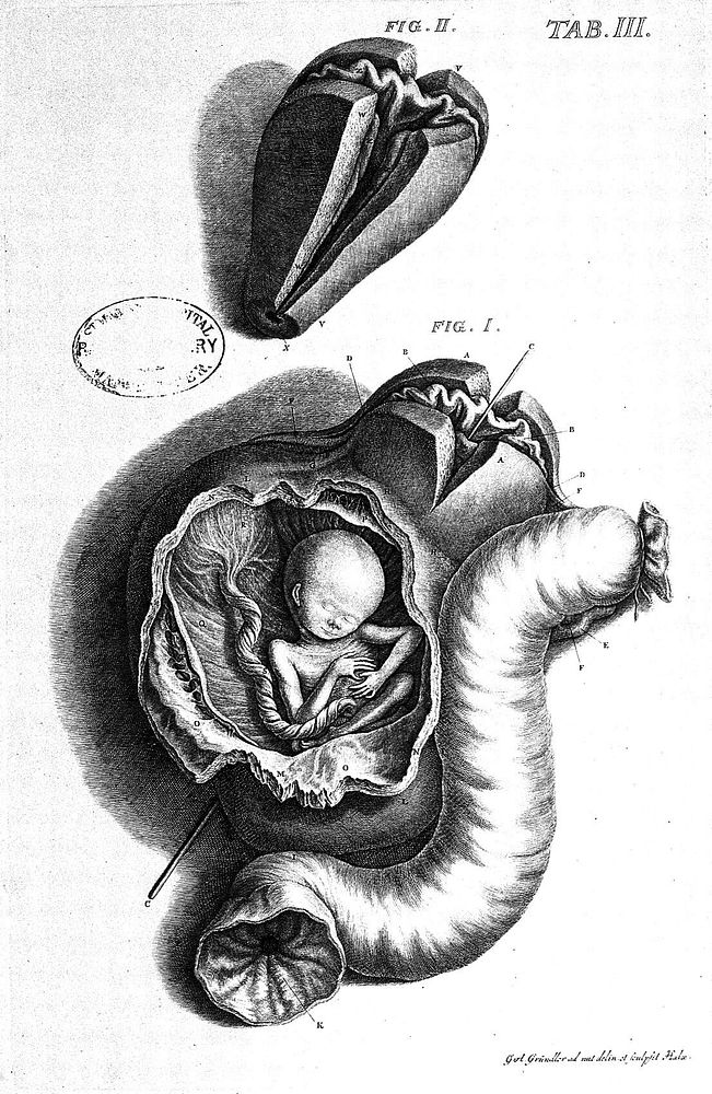 Observationum anatomicarum rariorum fasciculus notabilia circa uterum humanum continens / [Philipp Adolph Boehmer].