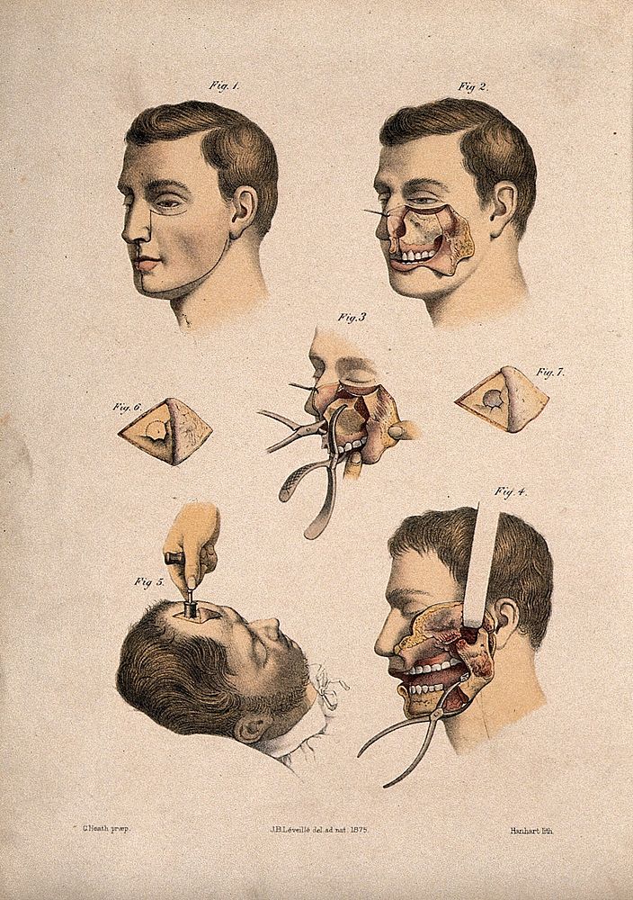Cross-sections through the human face and jaw. Coloured lithograph by M. Hanhart after C. Heath after J.B. Léveillé.