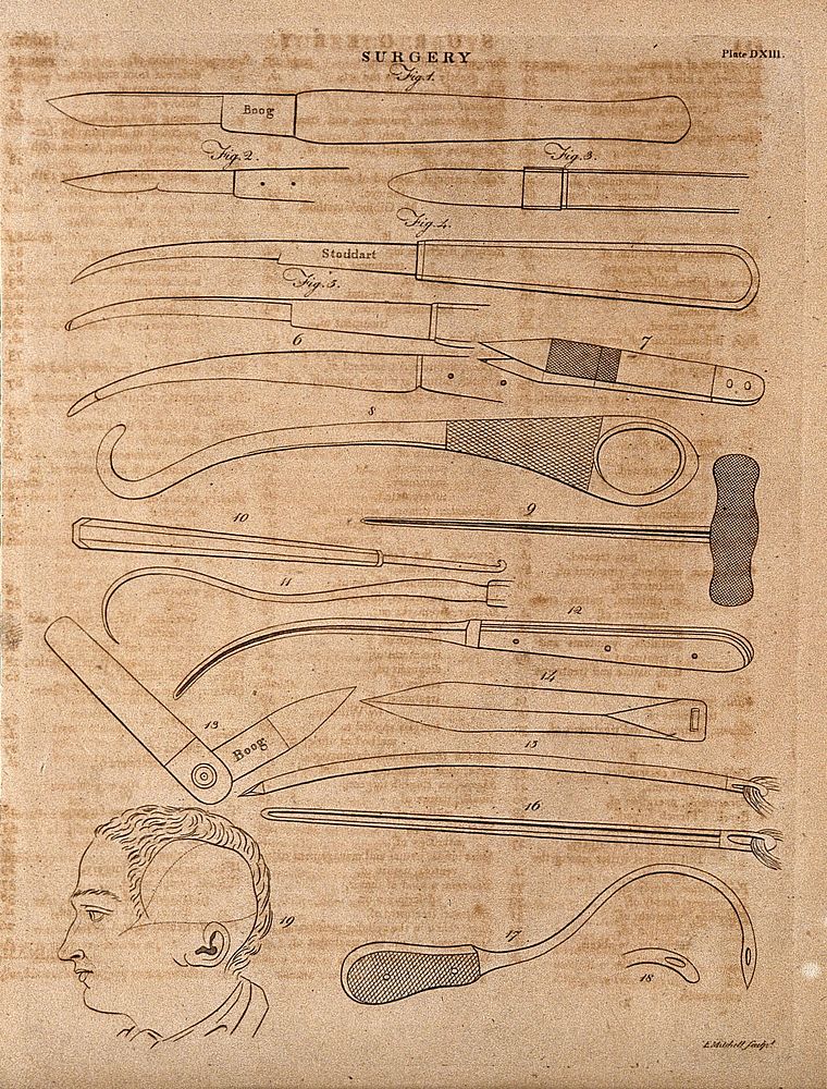 Surgical instruments, mainly needles and knives. Engraving by E. Mitchell.