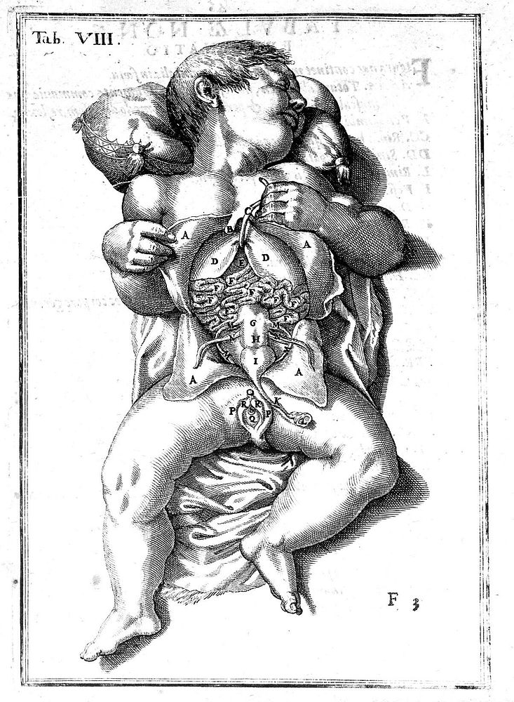 Adriani Spigelii Brvxellensis Eqvitis D. Marci ... De formato foetv liber singularis aeneis figvris exornatvs. Epistolæ dvæ…