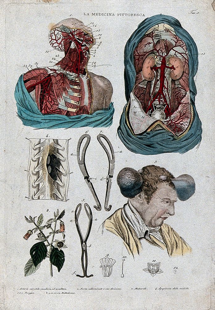 Anatomy and botany; top left, dissected head and chest; top right, dissected thorax; centre left, forceps; centre right, man…