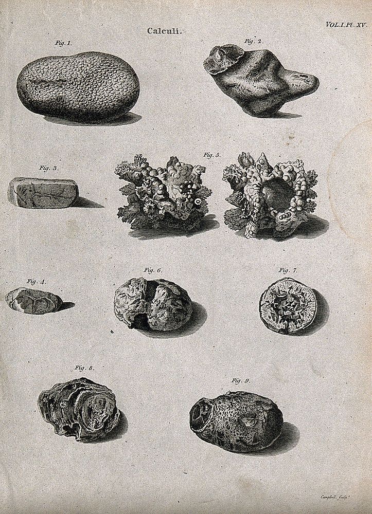 Calculi: 9 figures. Line engraving by Campbell, 1816/1821.