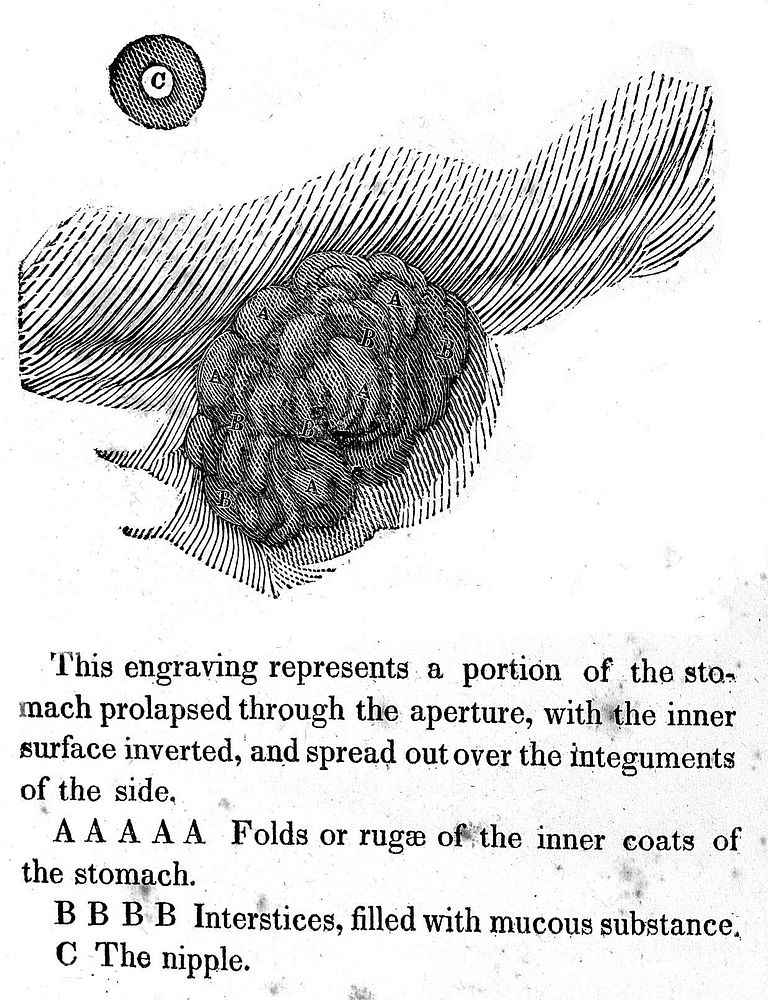 Experiments and observations on the gastric juice, and the physiology of digestion / By William Beaumont.
