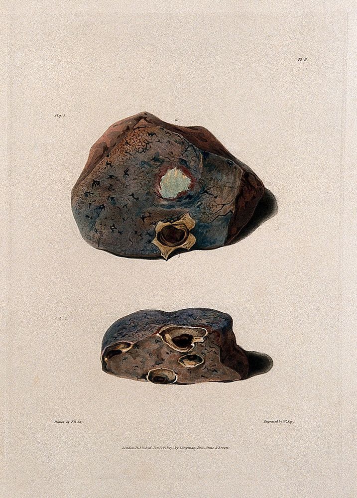 Two sections of diseased lung. Coloured aquatint by W. Say after F. R. Say for Richard Bright, 1827.