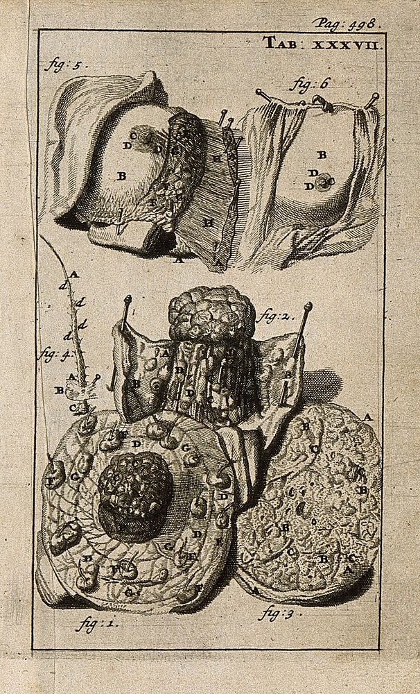 The breast dissected and the nipple and areola and a hair as viewed under a microscope. Engraving, 1686.