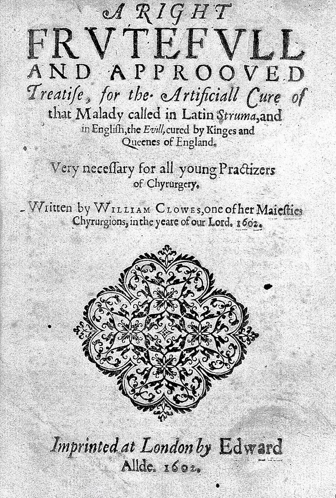 A right frutefull and approoved treatise, for the artificiall cure of that malady called in Latin Struma, and in English the…