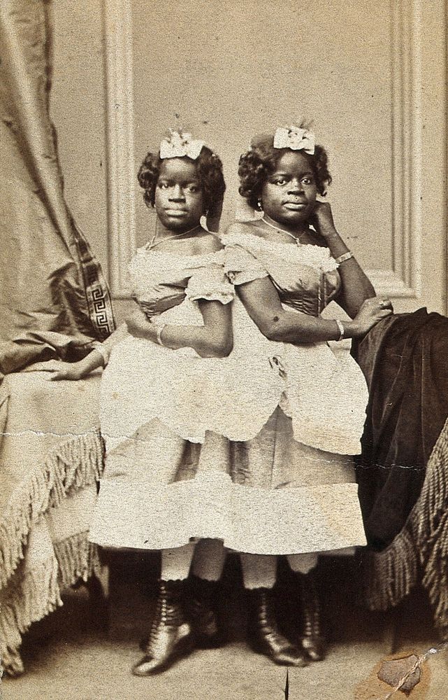 The Millie-Christine sisters, conjoined twins: aged 19, standing. Photograph, 1871.