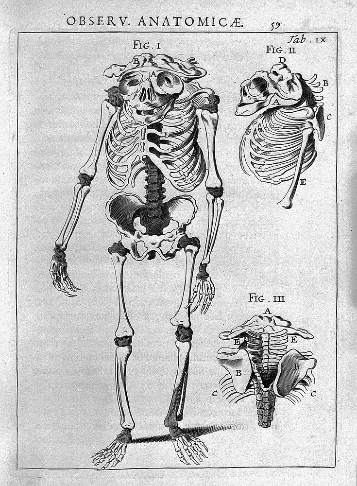 Spicilegium anatomicum, continens observationum anatomicarum rariorum centuriam unam: nec non Osteogeniam foetuum ... /…