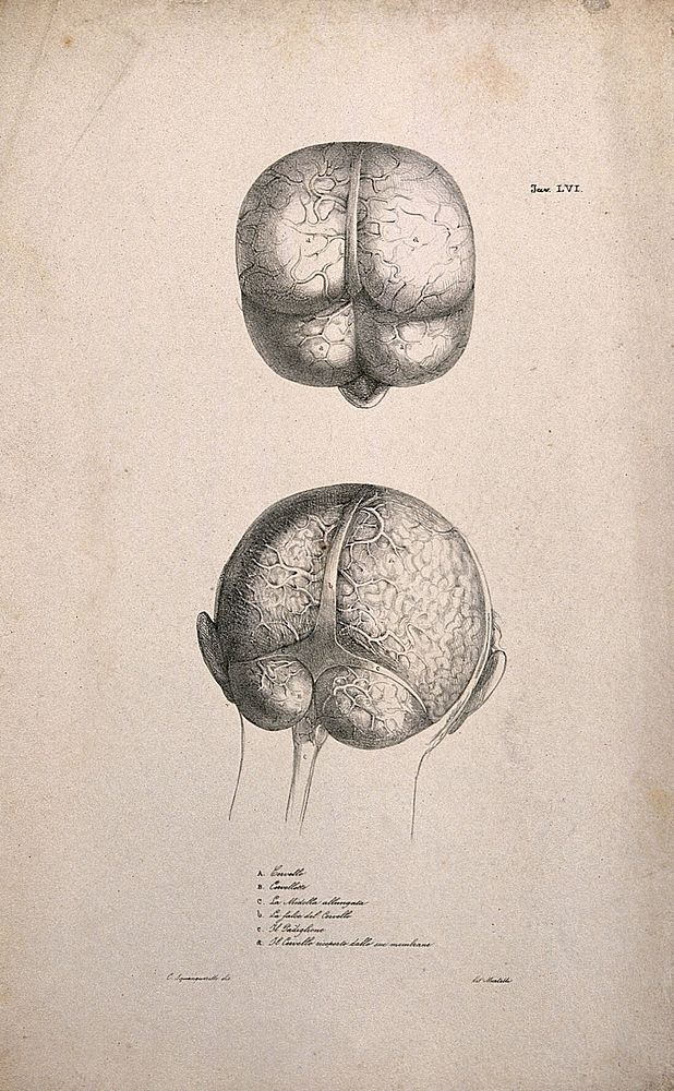 Brain: two figures, including one showing the brainstem and nerves. Lithograph by Martelli after C. Squanquerillo, ca. 1840.