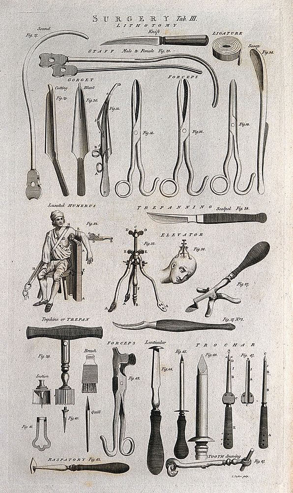 Surgical instruments for lithotomy operations, including knives, ligatures and forceps. Engraving by J. Taylor.