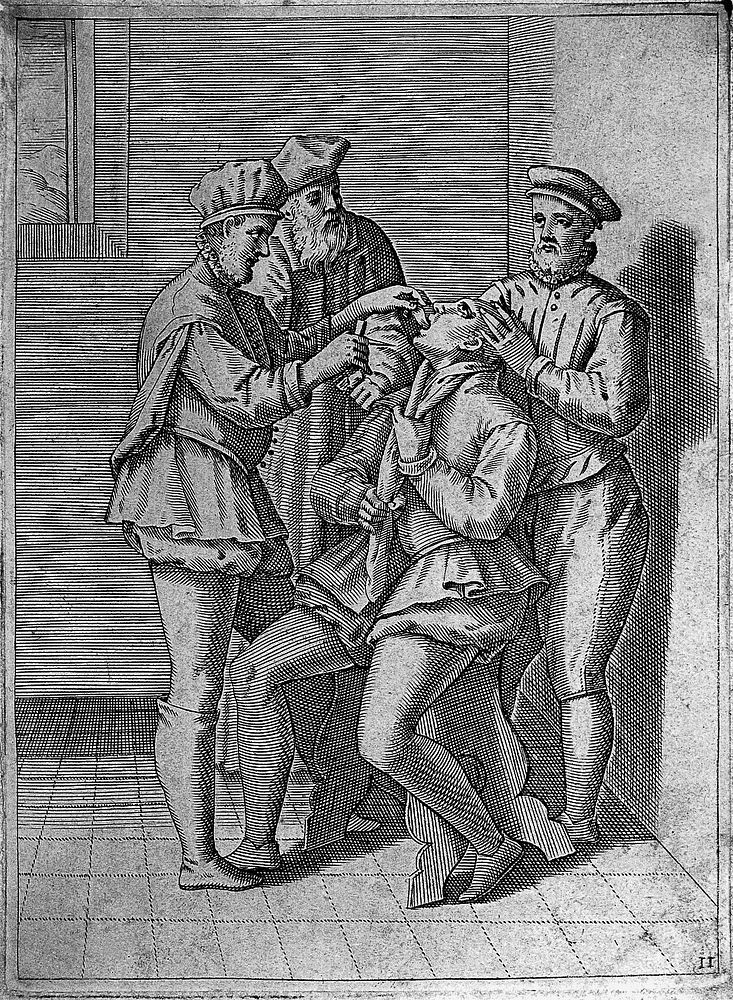 A surgeon about to bleed a man's tongue, he is aided by two assistants. Engraving, 1586.