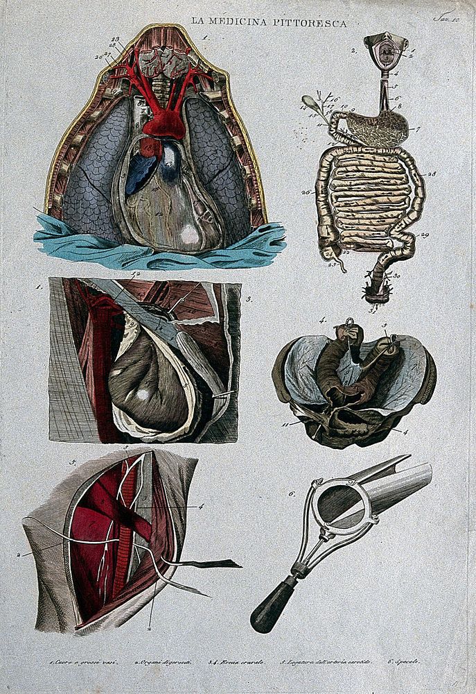 Top left, section of the heart; top right, intestines; centre left and right, hernia; bottom left, carotide; bottom right…