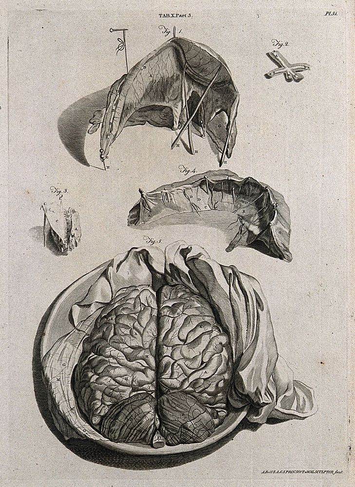 The brain, viewed with the skull removed (below); parts of the brain including the dura mater and the falx (four figures…