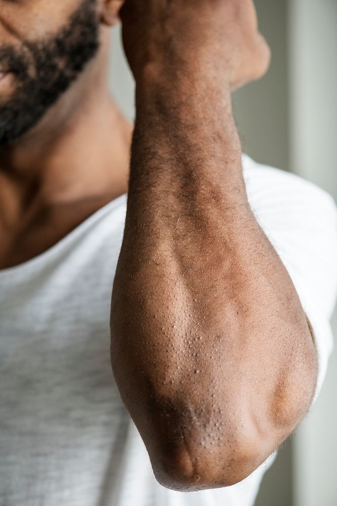 Closeup of black person's arm