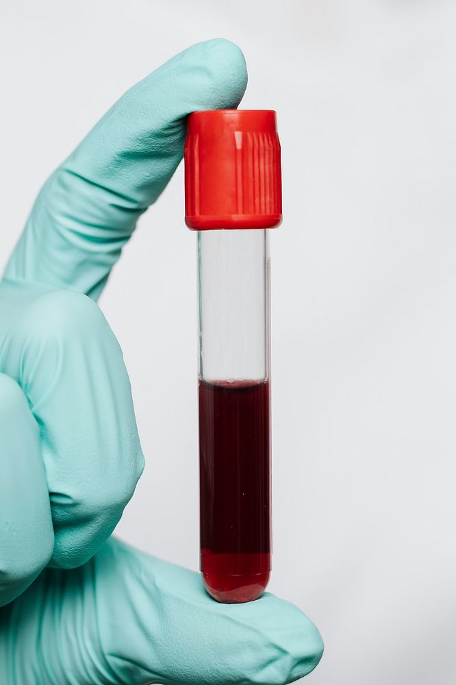 Hand holding a blood test tube 