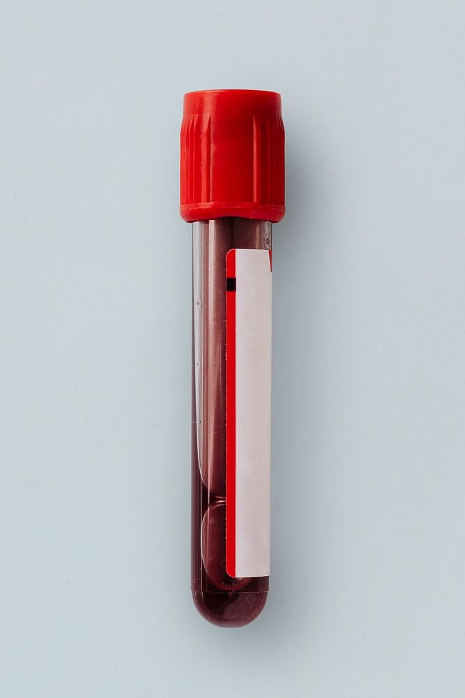 Blood test tube in a lab 