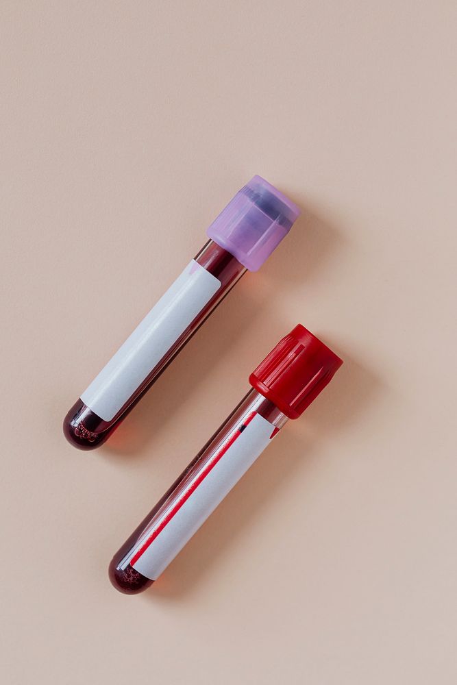 Blood test tubes on a beige background