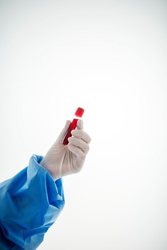 Doctor holding a blood test tube