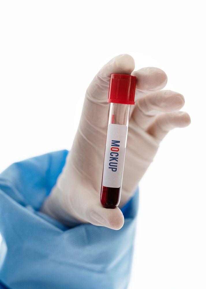 Doctor holding a blood test tube mockup
