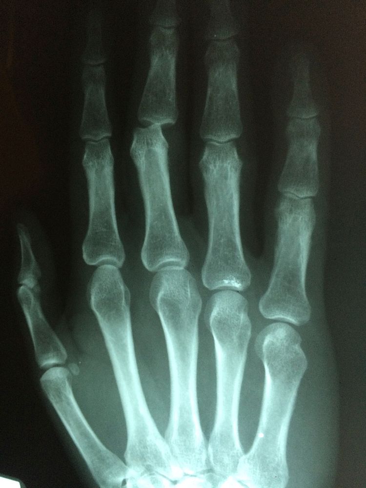 Xray scan of hand. Free public domain CC0 image.