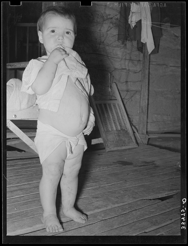 Child of tenant farmer. Notice distended stomach, indicative of malnutrition. Near Warner, Oklahoma by Russell Lee