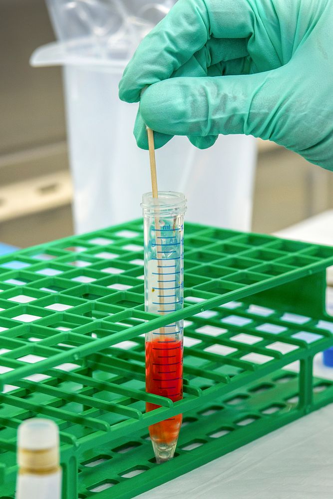 A scientist adding a stool sample to the cell culture medium, along with glass beads. Original image sourced from US…