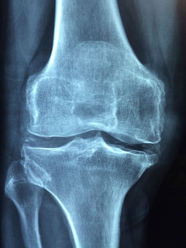 Free knee CT scan image, public domain CC0 photo.