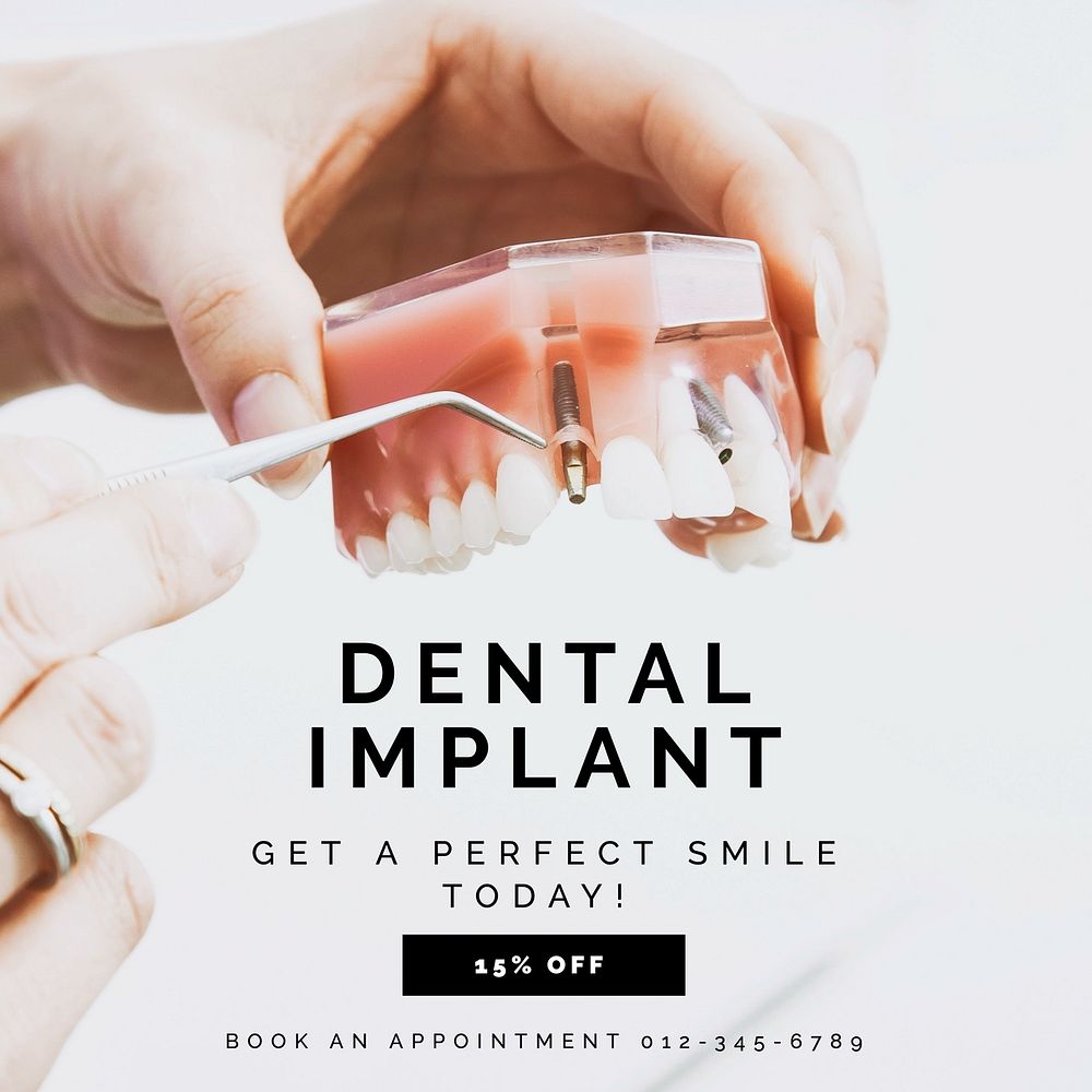 Dental implant Instagram post template
