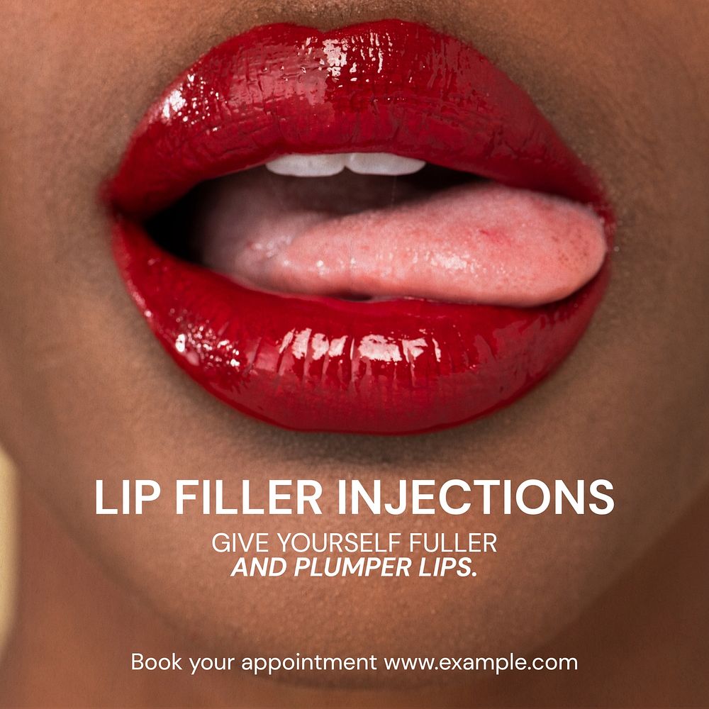 Lip filer injections Instagram post template
