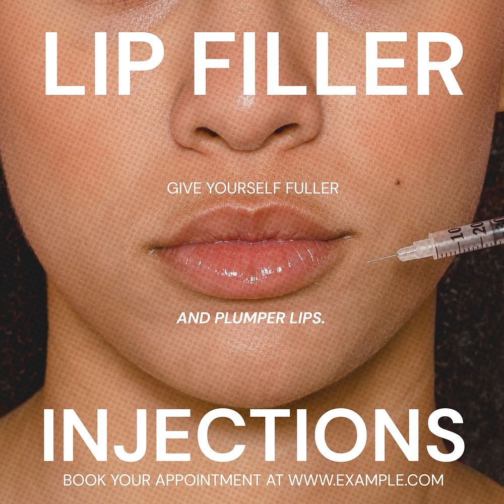Lip filer injections Instagram post template
