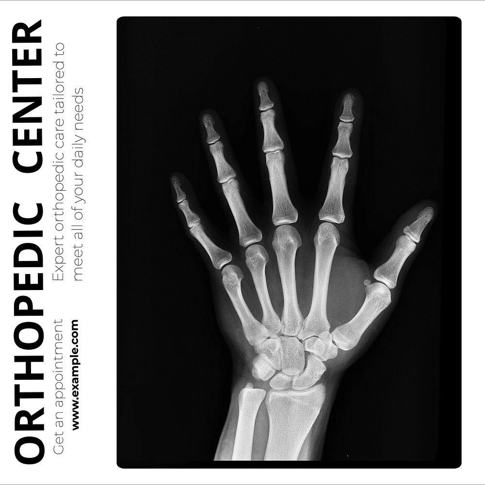 Orthopedic center Instagram post template