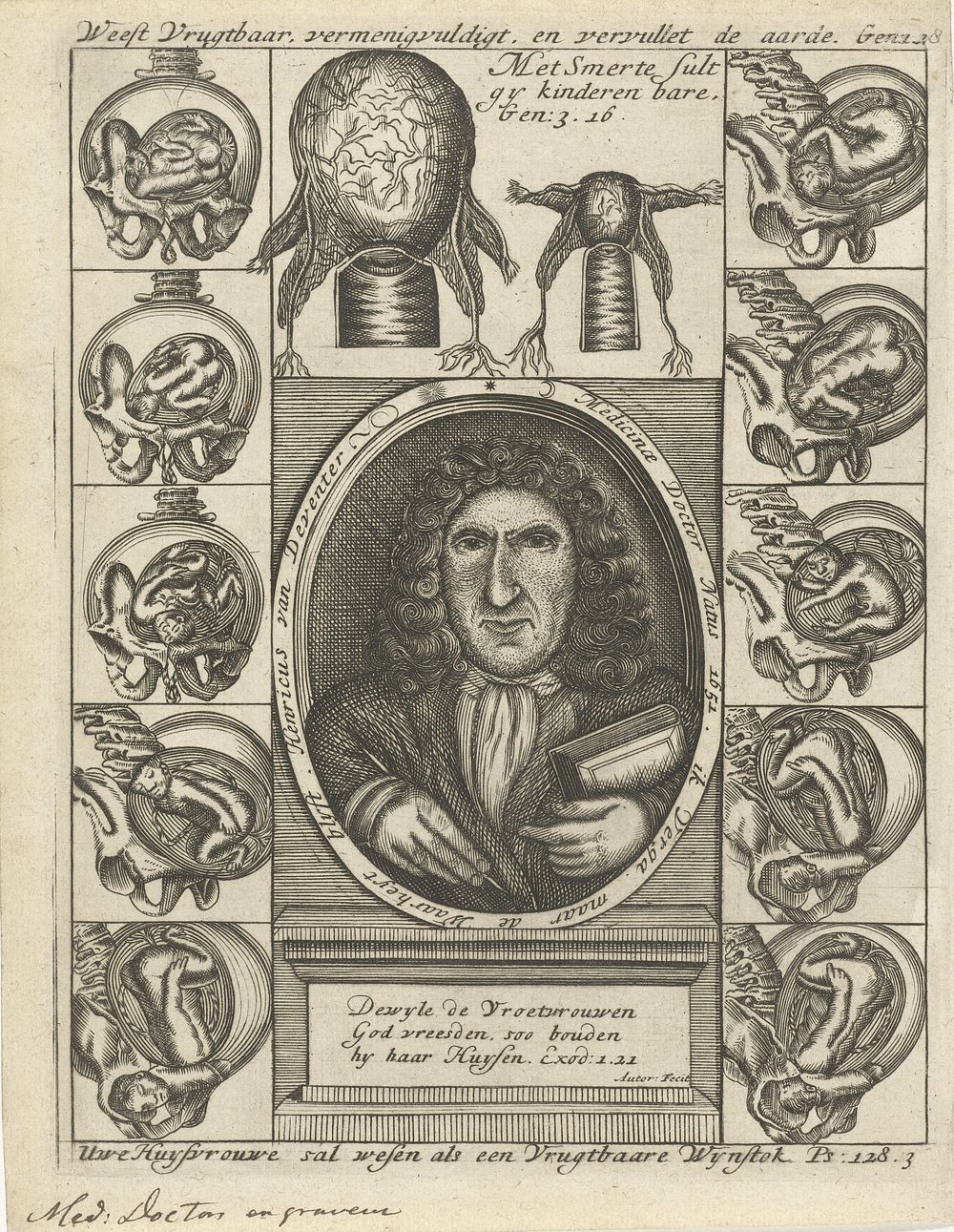 Portret van Hendrik van Deventer en anatomische tekeningen van baarmoeders met foetus (1701) by Hendrik van Deventer