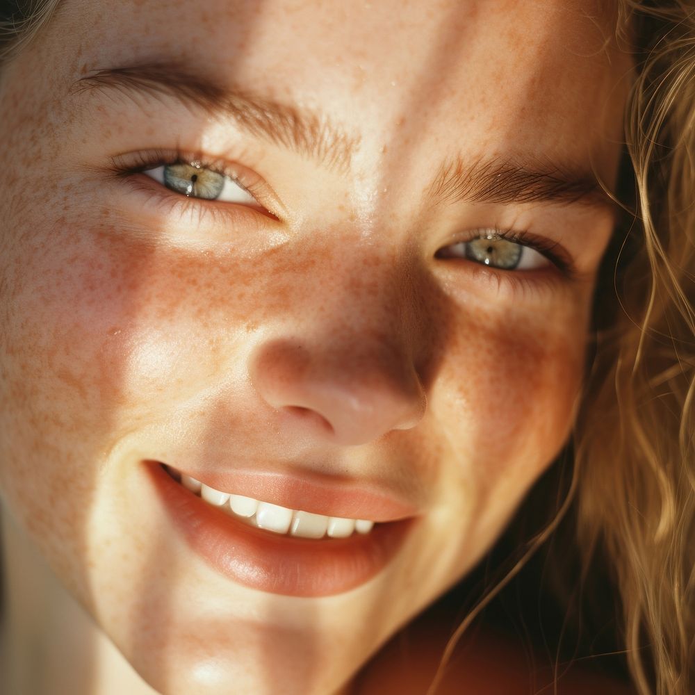 Closeup female face skin freckle summer.