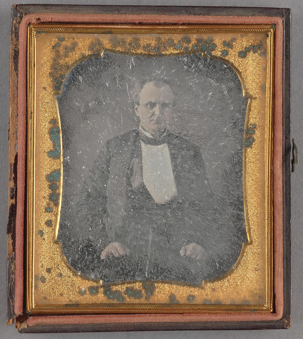 Portrait of a Seated Man with Receding Hair Line
