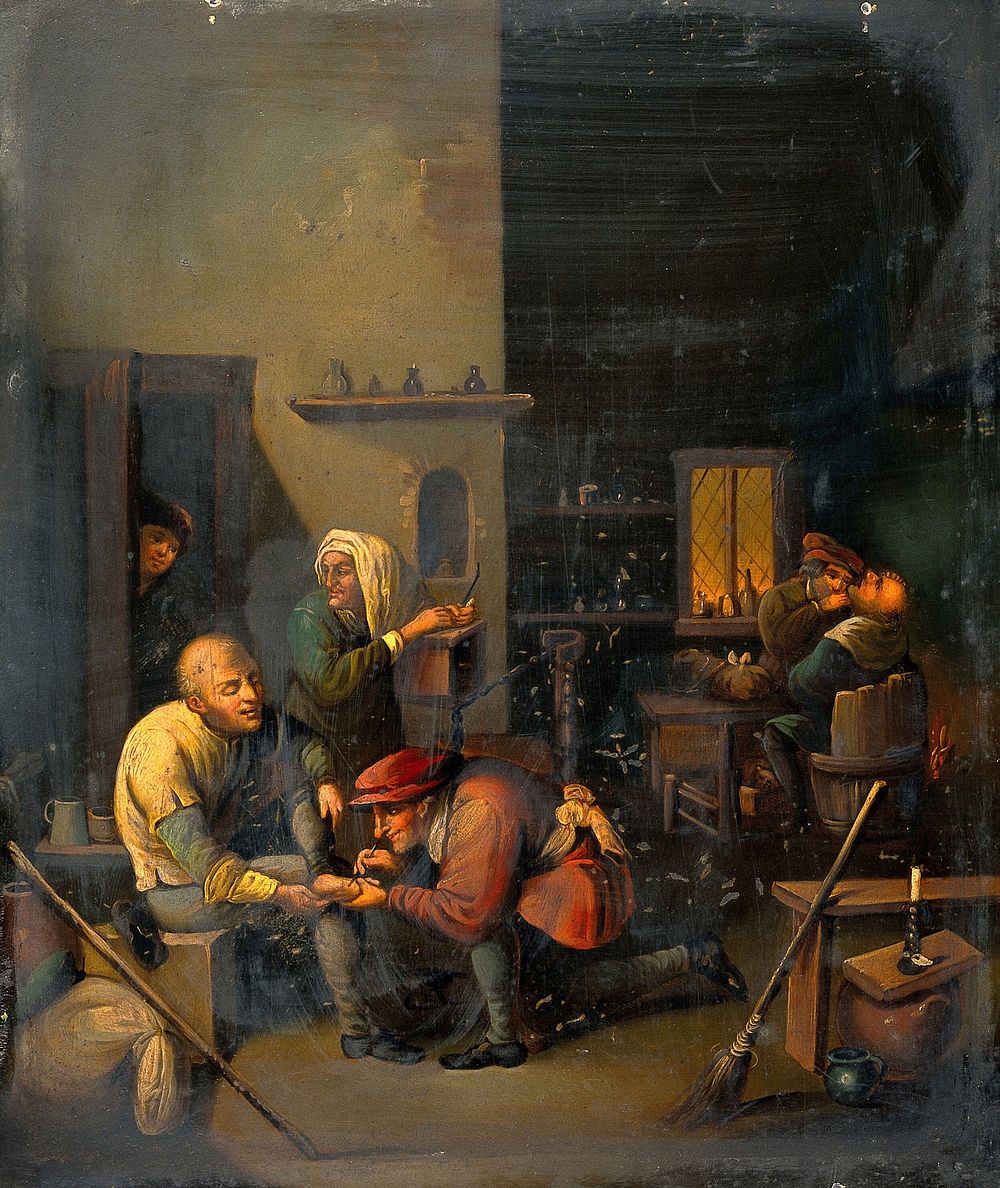 A surgeon operating on a man's foot. Oil painting after A. Brouwer.