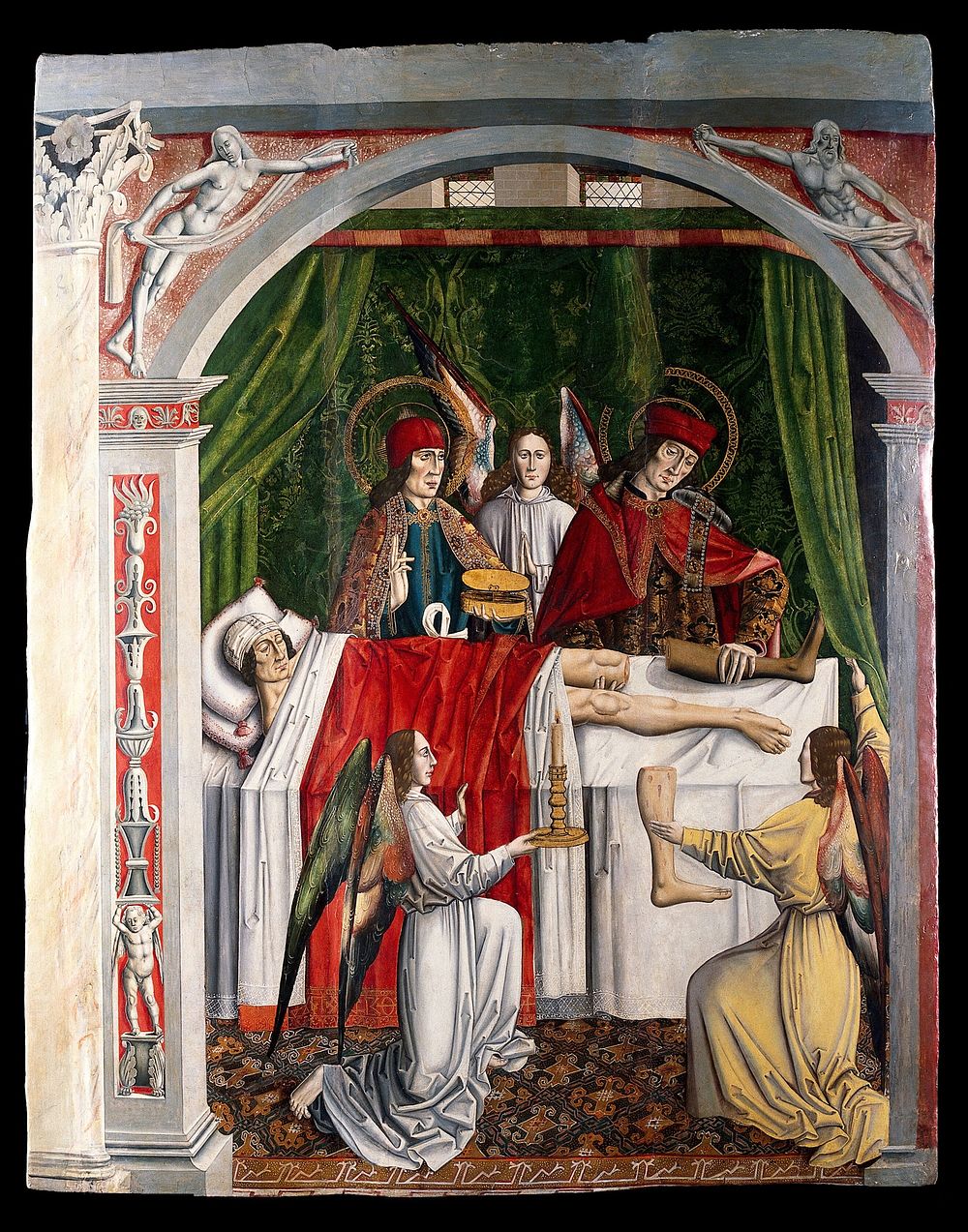 A verger's dream: Saints Cosmas and Damian performing a miraculous cure by transplantation of a leg. Oil painting attributed…