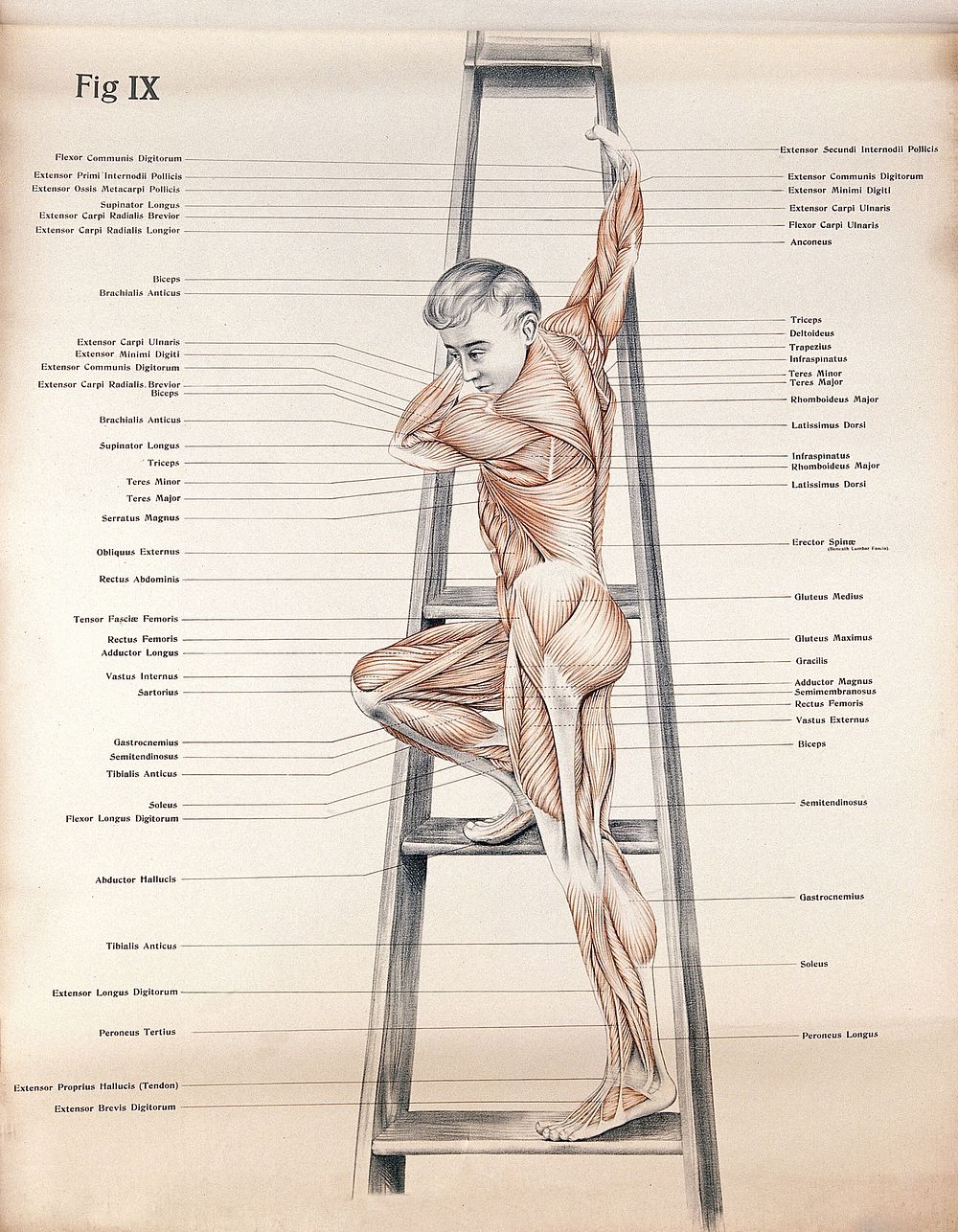 Artistic poses, plate IX: a man écorché climbing a ladder. Lithograph by Robert J. Colenso.