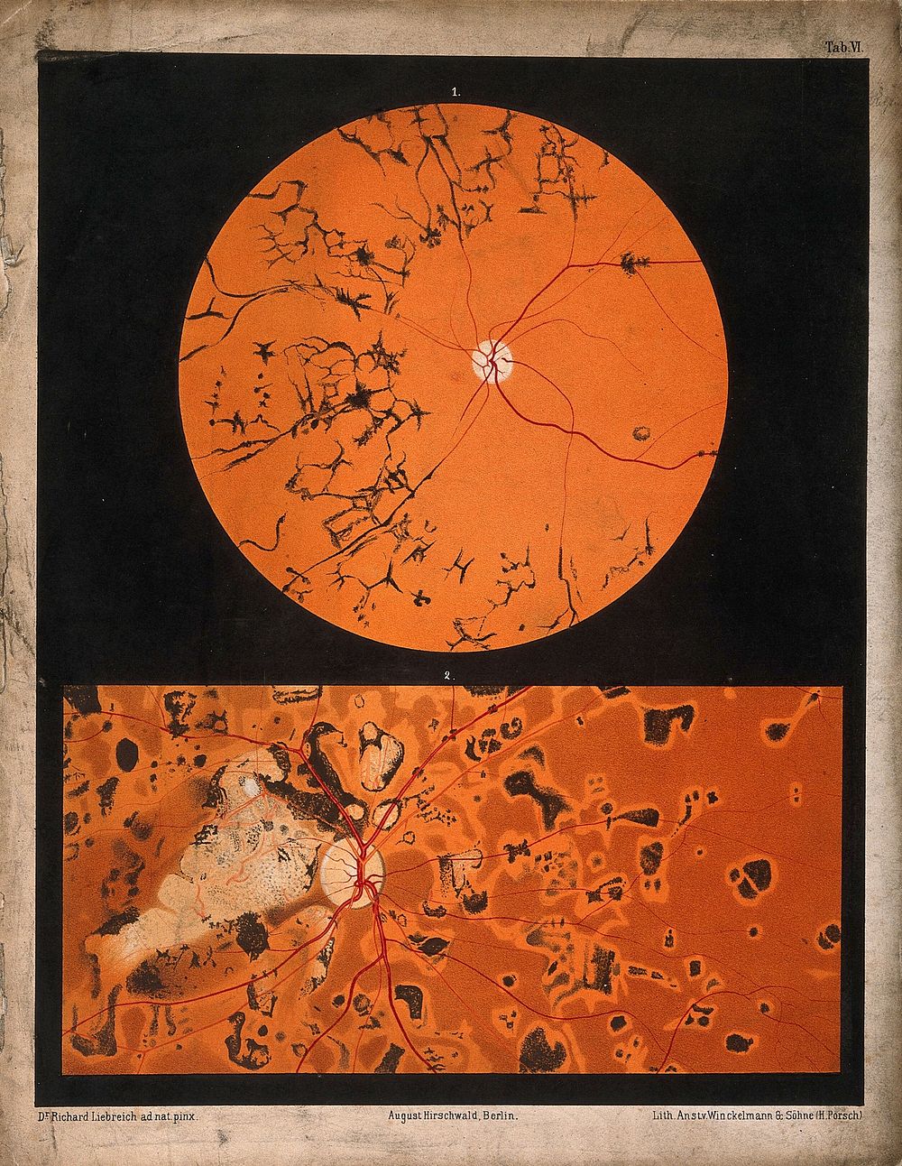 The eye, as seen through a microscope: two figures. Colour lithograph after R. Liebreich, ca. 1860.