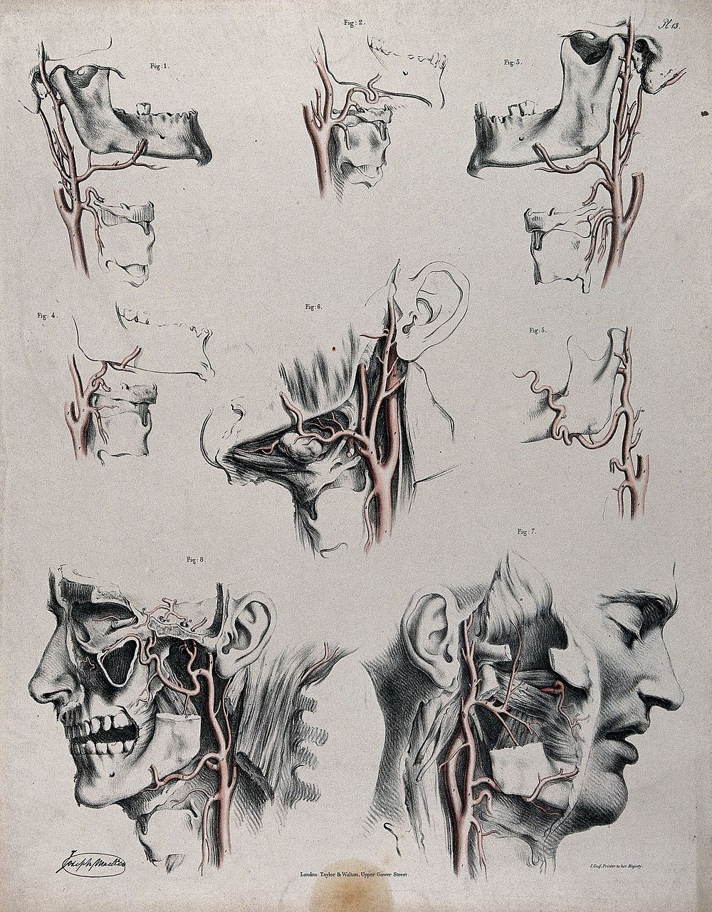 The circulatory system: dissections of the neck, jaw and face of a man, with arteries and blood vessels indicated in red.…