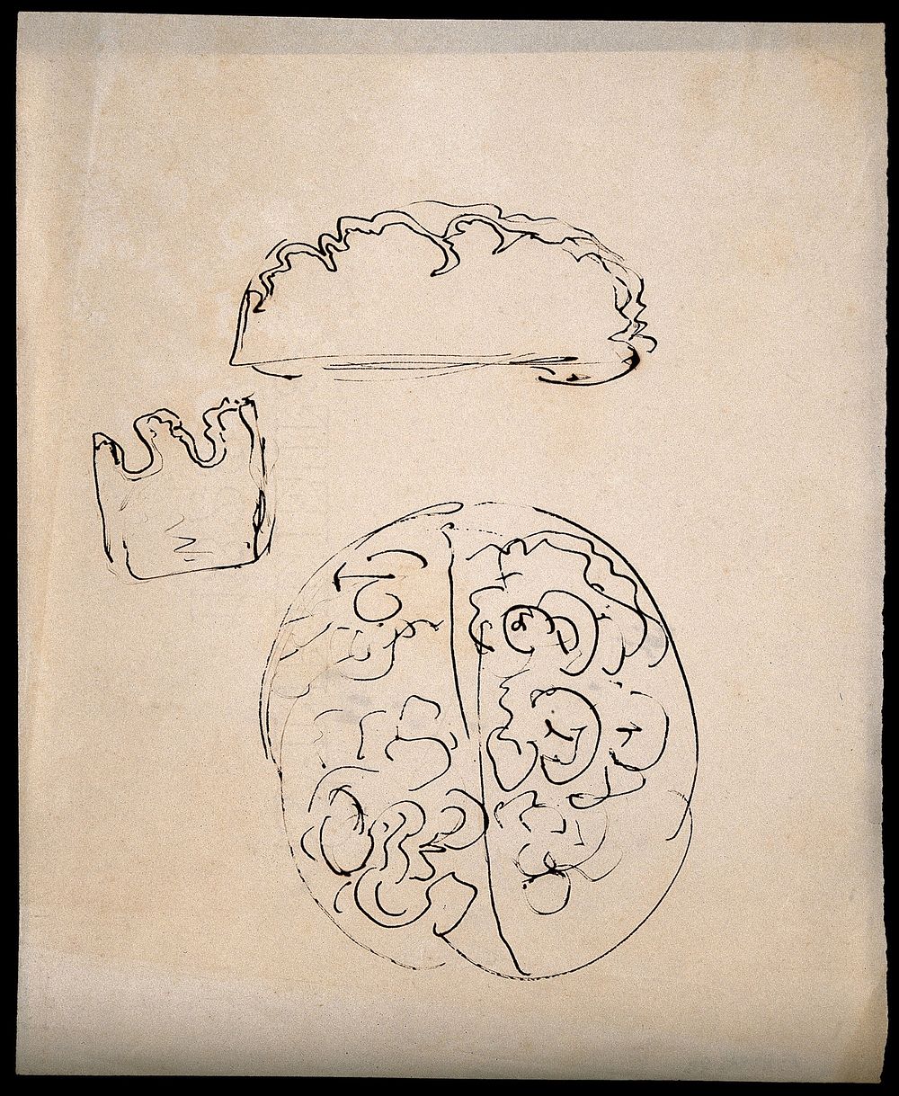 A brain; and two sections of brain . Drawing.