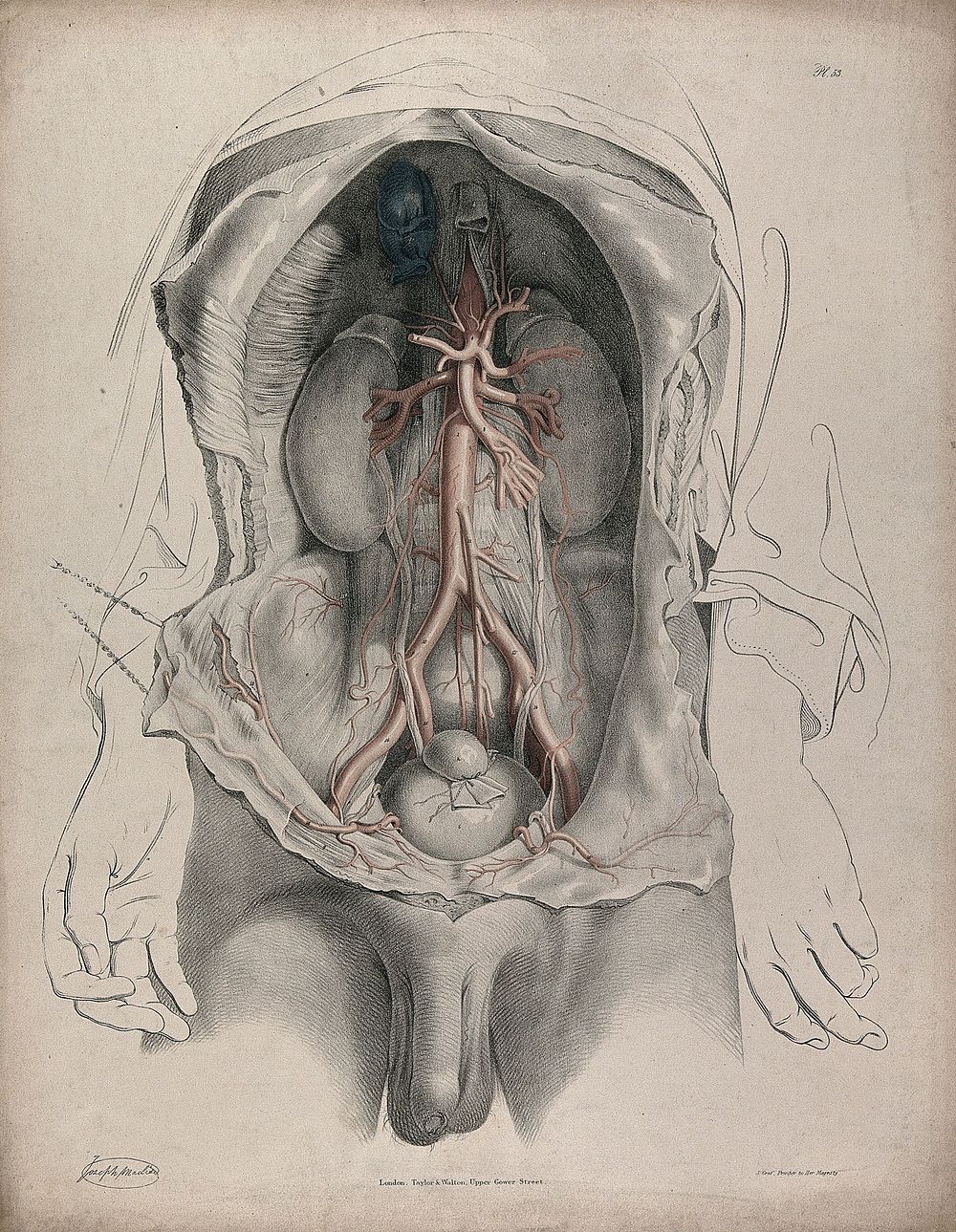 The circulatory system: dissection of the torso showing the kidneys and bladder, with the arteries and veins indicated in…