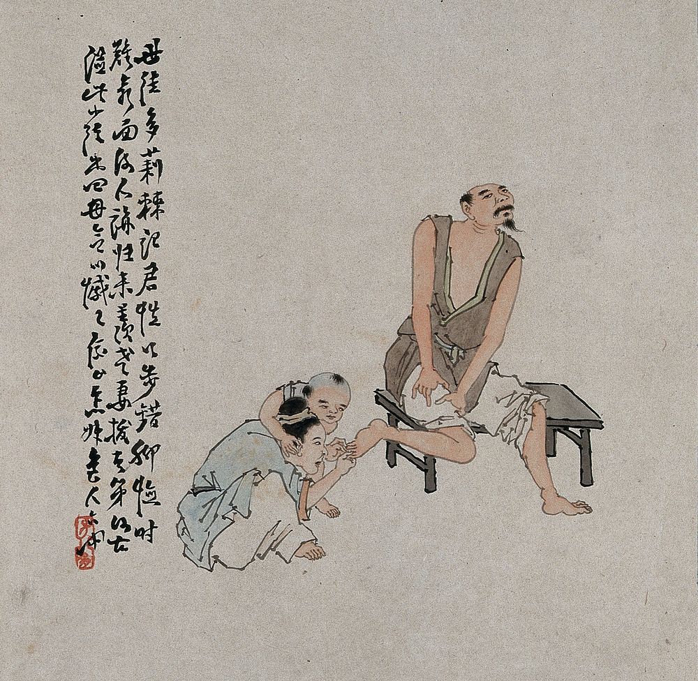 A Chinese man with is attended upon by a woman and child who try to pick out a thorn from his foot. Gouache painting by a…