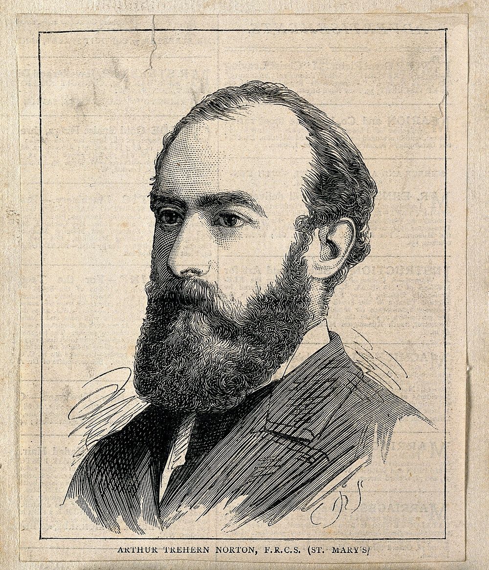 Arthur Trehern Norton. Wood engraving by Charles Roberts.