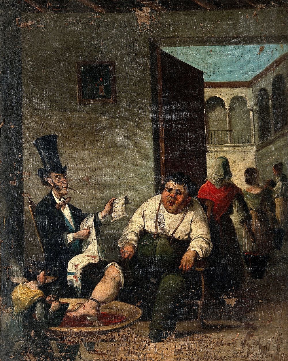 Bloodletting from the foot. Oil painting after H. Daumier.